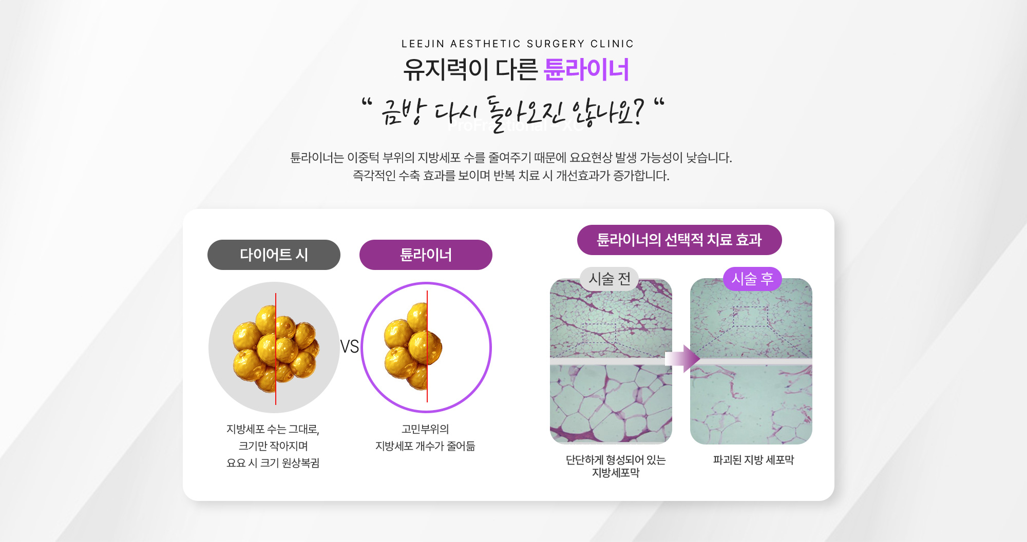 유지력이 다른 튠라이너